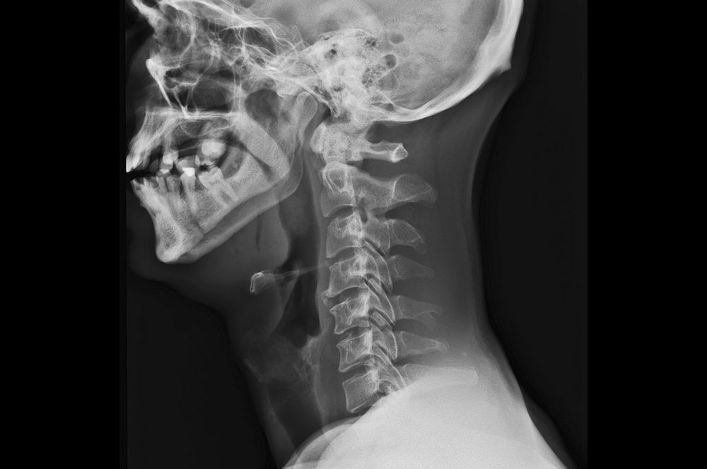 Traumatología