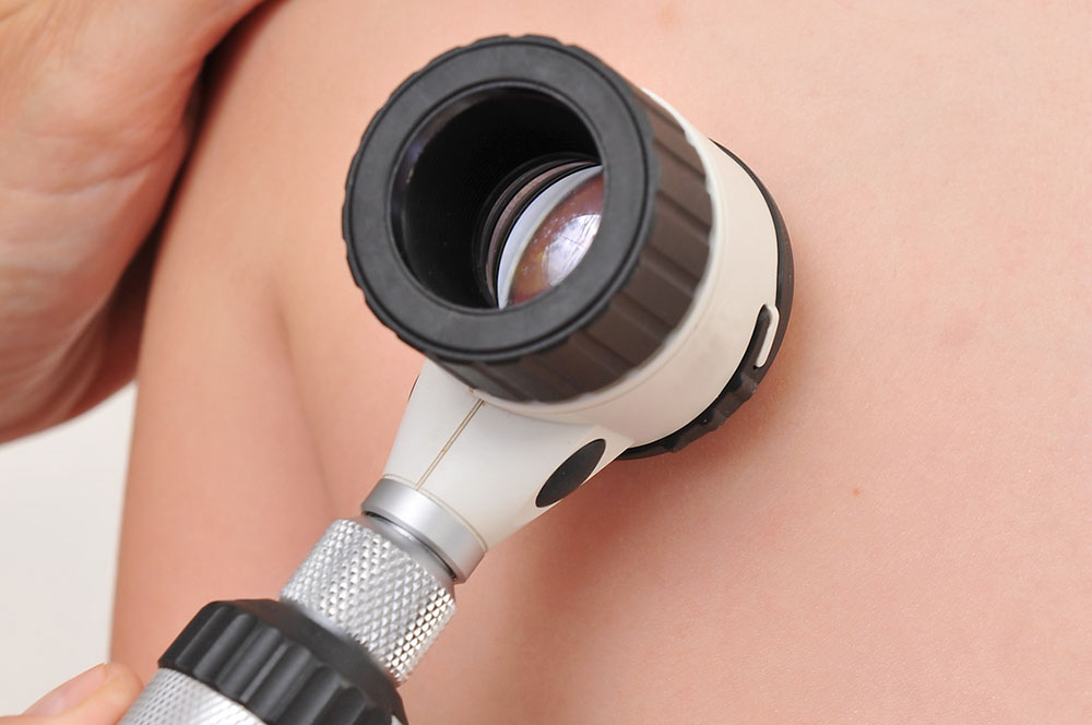 Dermatología
